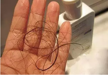 老掉发可能是洗头方法错了！这10个洗头错误，让你洗发变毁发！